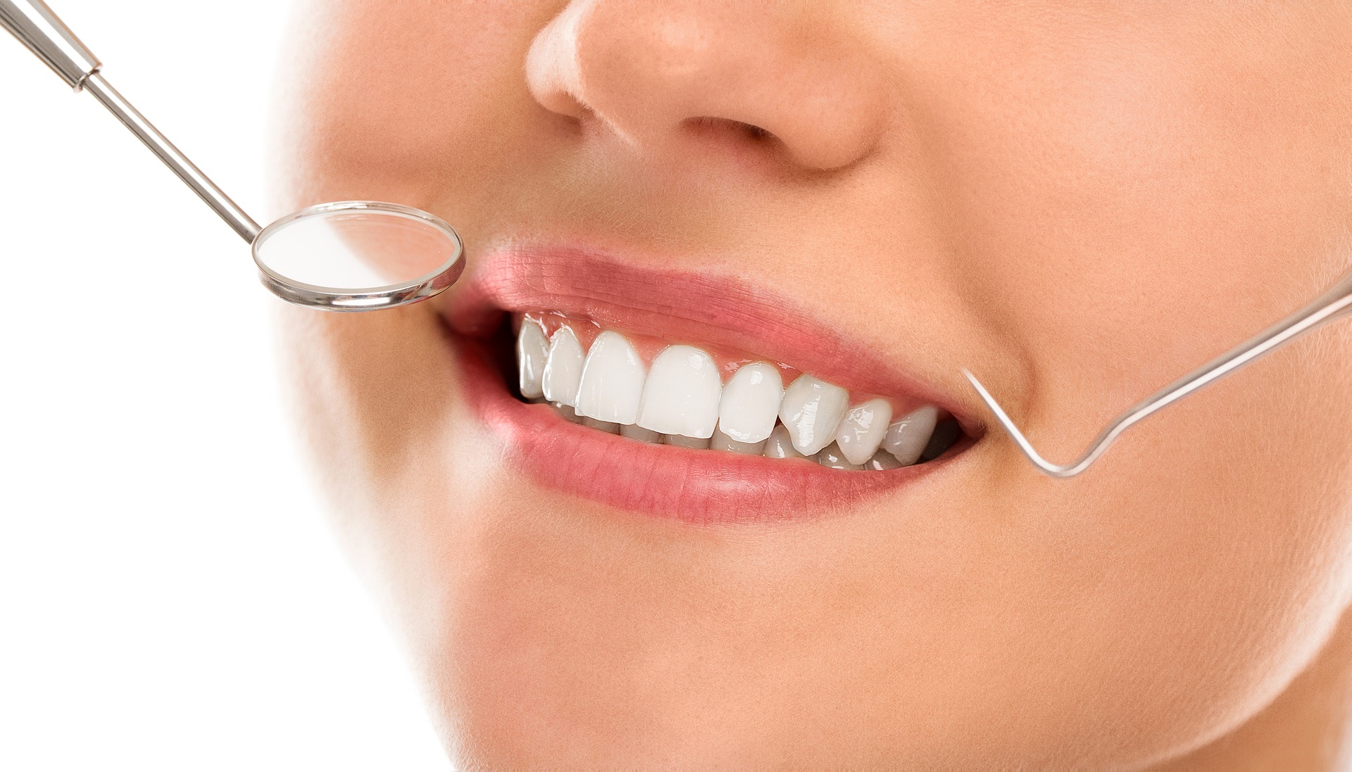 Blanqueamiento dental